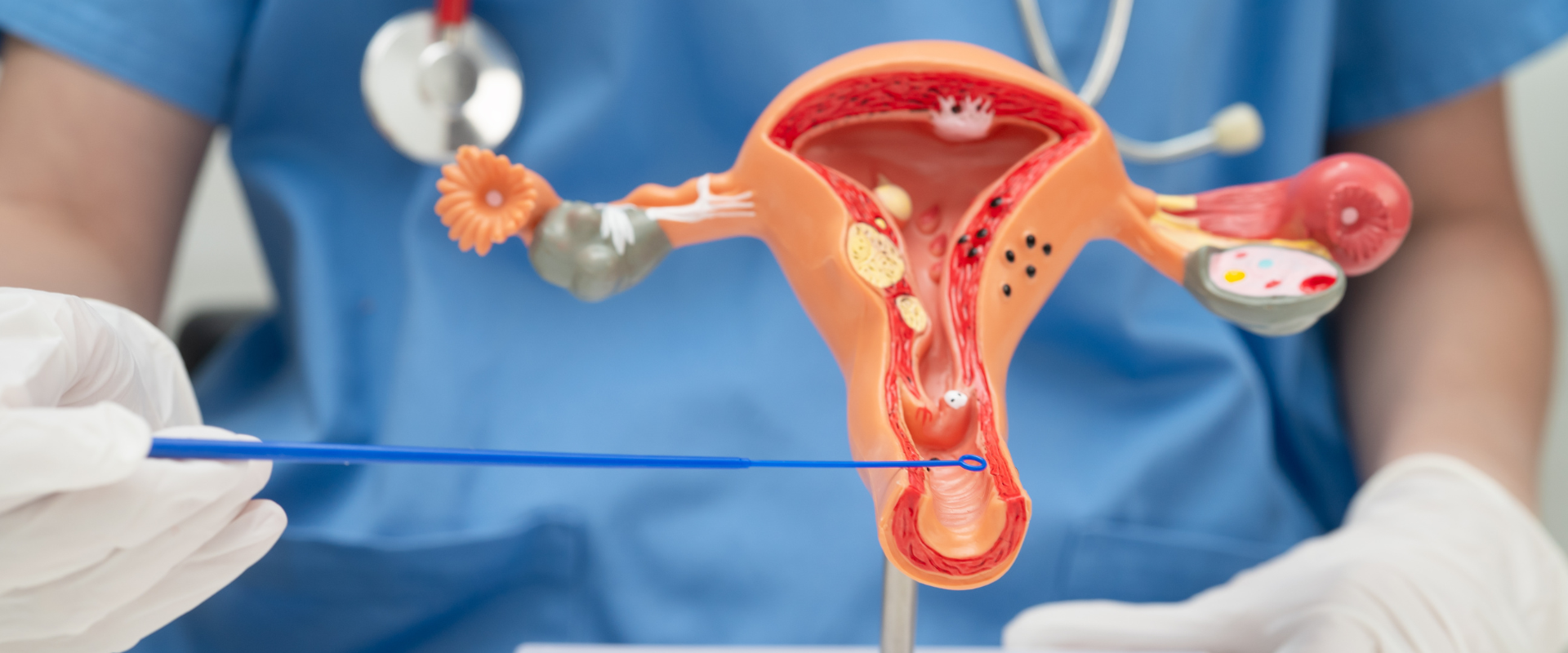 Virus del Papiloma Humano (VPH): lo que toda mujer debe saber sobre prevención y detección