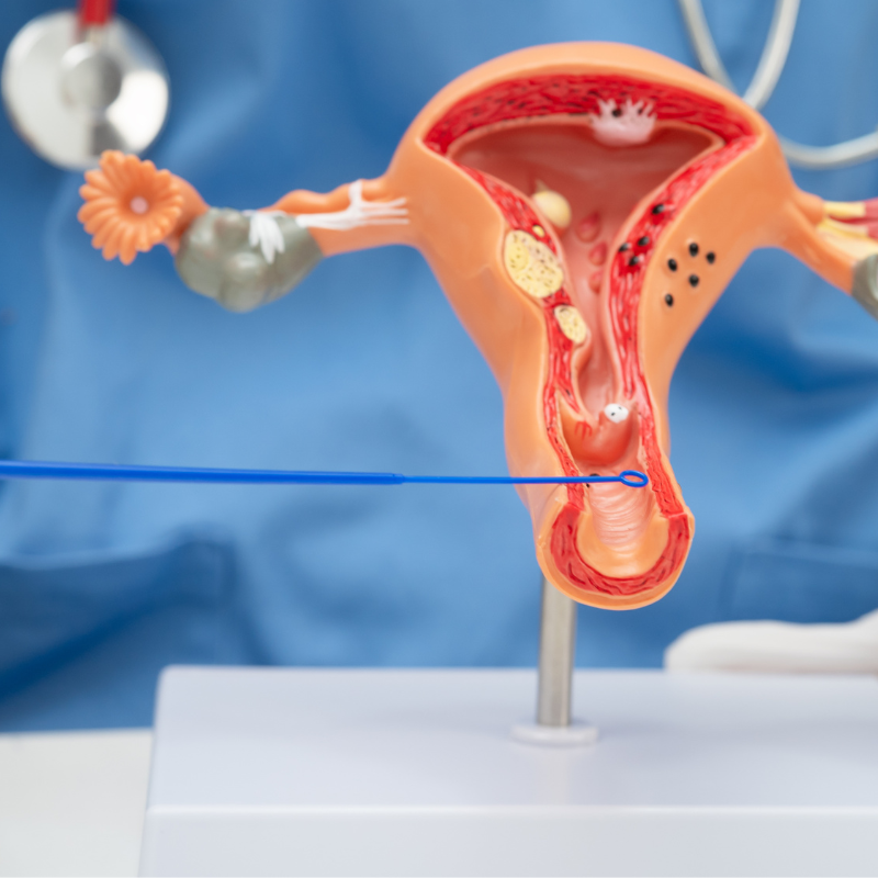 Virus del Papiloma Humano (VPH): lo que toda mujer debe saber sobre prevención y detección